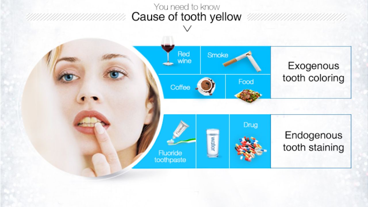 Best Ways to Clean Teeth with Whitening Strips: Smoking, Coffee, and Tea Stains